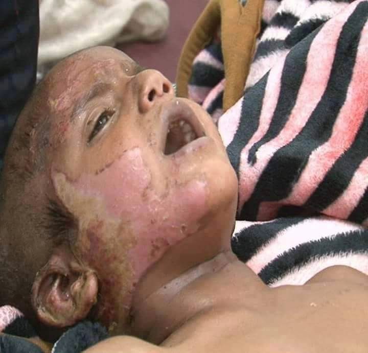 Yemen_War_Image